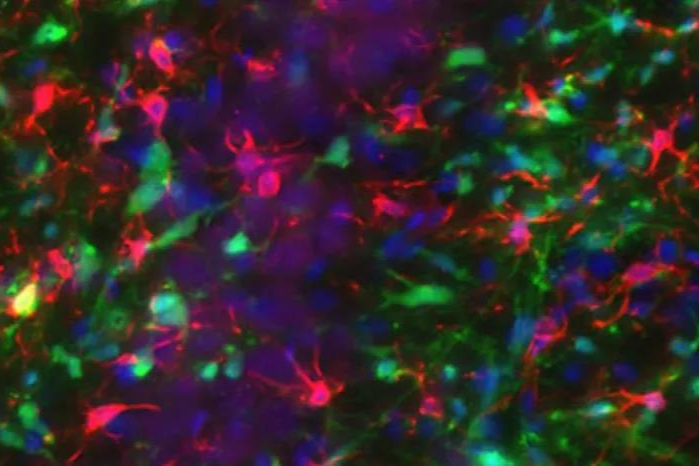 推进神经元细胞疗法治疗癫痫获4150万美元融资