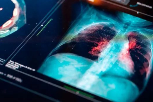 首个非小细胞肺癌HER2靶向药获批上市！Enhertu新适应症拓展