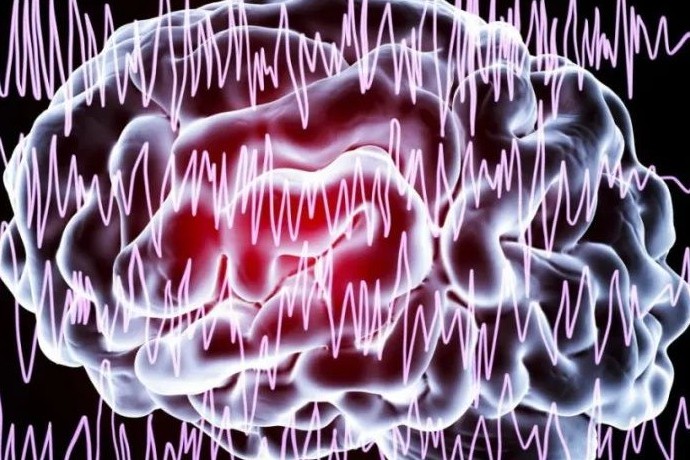 新论｜有望治疗癫痫的AVV基因疗法找到！