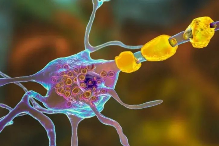 这家血友病基因疗法先驱企业，为削减开支，做出三大动作！