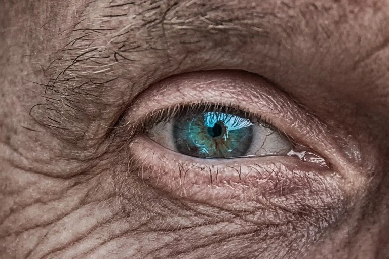 AAV基因药物AL-001国内完成首例受试者给药