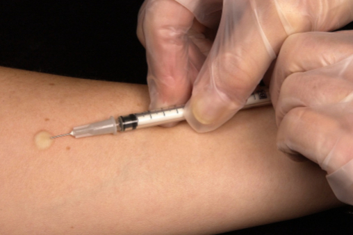 齐鲁爆发！拿下第3家「地舒单抗」、高难制剂首仿、$20亿抗精神病药