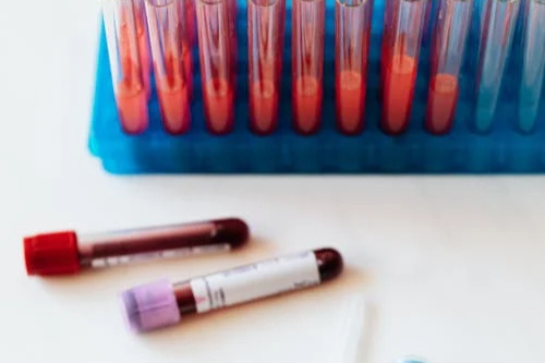 2024年心血管疾病全球流行病学概况丨流行病学、危险因素与政策动向