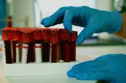 六类耗材成焦点，河北医保局加速血管介入全国联采新篇章