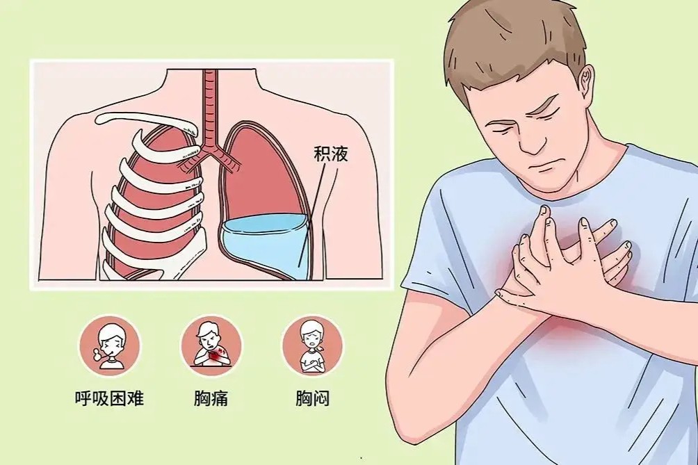 哮喘患病率攀升，中成药领跑零售市场，药企迎来布局良机