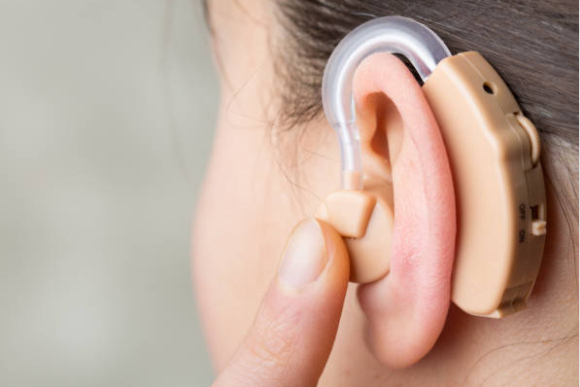 第五批国采全面执行：人工耳蜗与血管支架降价在即！