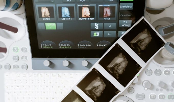 超声在治疗癌症、炎症性疾病方面的潜在作用