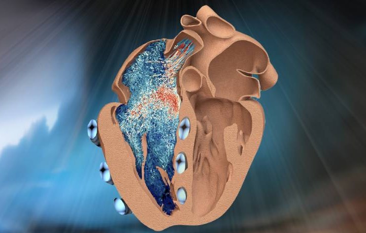 麻省理工学院研发了一种心脏机器(右心室)，可模仿心跳与血液泵送