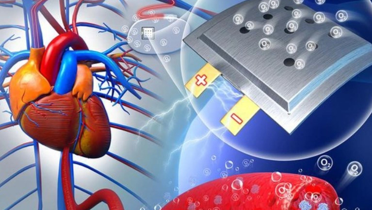 医疗植入式设备未来技术：人体自身氧气提供燃料的植入式电池