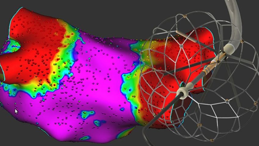 美敦力的 Sphere-360 脉冲场消融导管设计有一些新技巧
