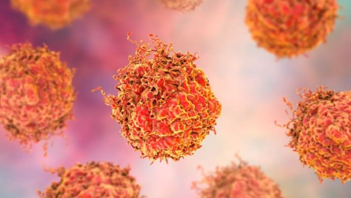 唾液检测识别患前列腺癌高危男性，超700人参与检测！