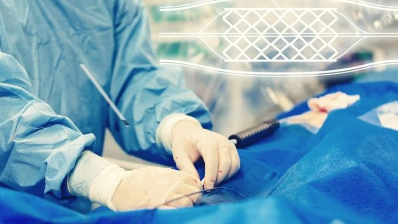 泰利福发生严重球囊导管召回事件，3人死亡与其有关！