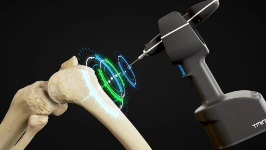 TMINI微型机器人系统（TMINI 1.1）已获得美国食品和药物管理局（FDA）的510（k）许可