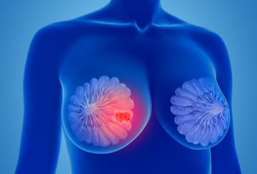 2025年欧洲肿瘤医学学会非洲峰会（ESMO Summit Africa）